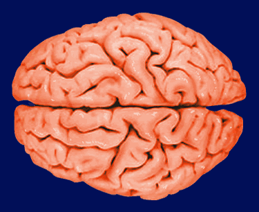 brain1.gif